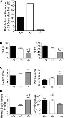 Pressure Overload in Mice With Haploinsufficiency of Striated Preferentially Expressed Gene Leads to Decompensated Heart Failure